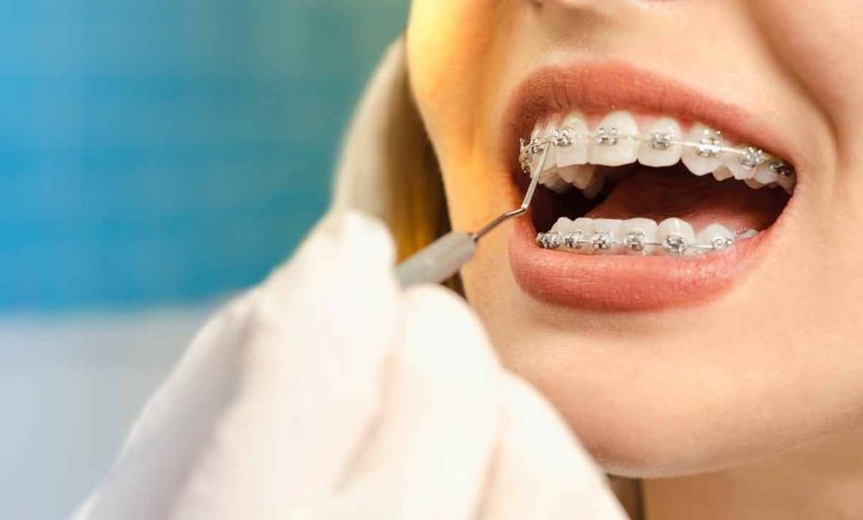 Unveiling the Best Carle Place Orthodontist: Your Gateway to a Dazzling Smile